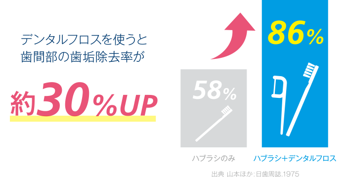 デンタルフロスを使うと歯間部の歯垢除去率が約30%UP